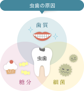 虫歯の原因「歯質」「糖分」「細菌」